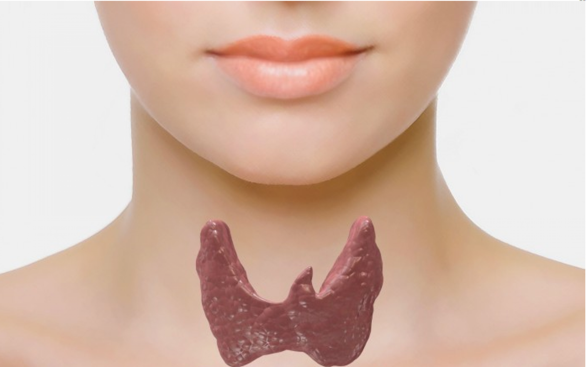 Зоб ахан. Аденома щитовидной железы. Здоровая щитовидная железа. Щитовидная железа в форме бабочки. Щитовидная железа фото у женщин.