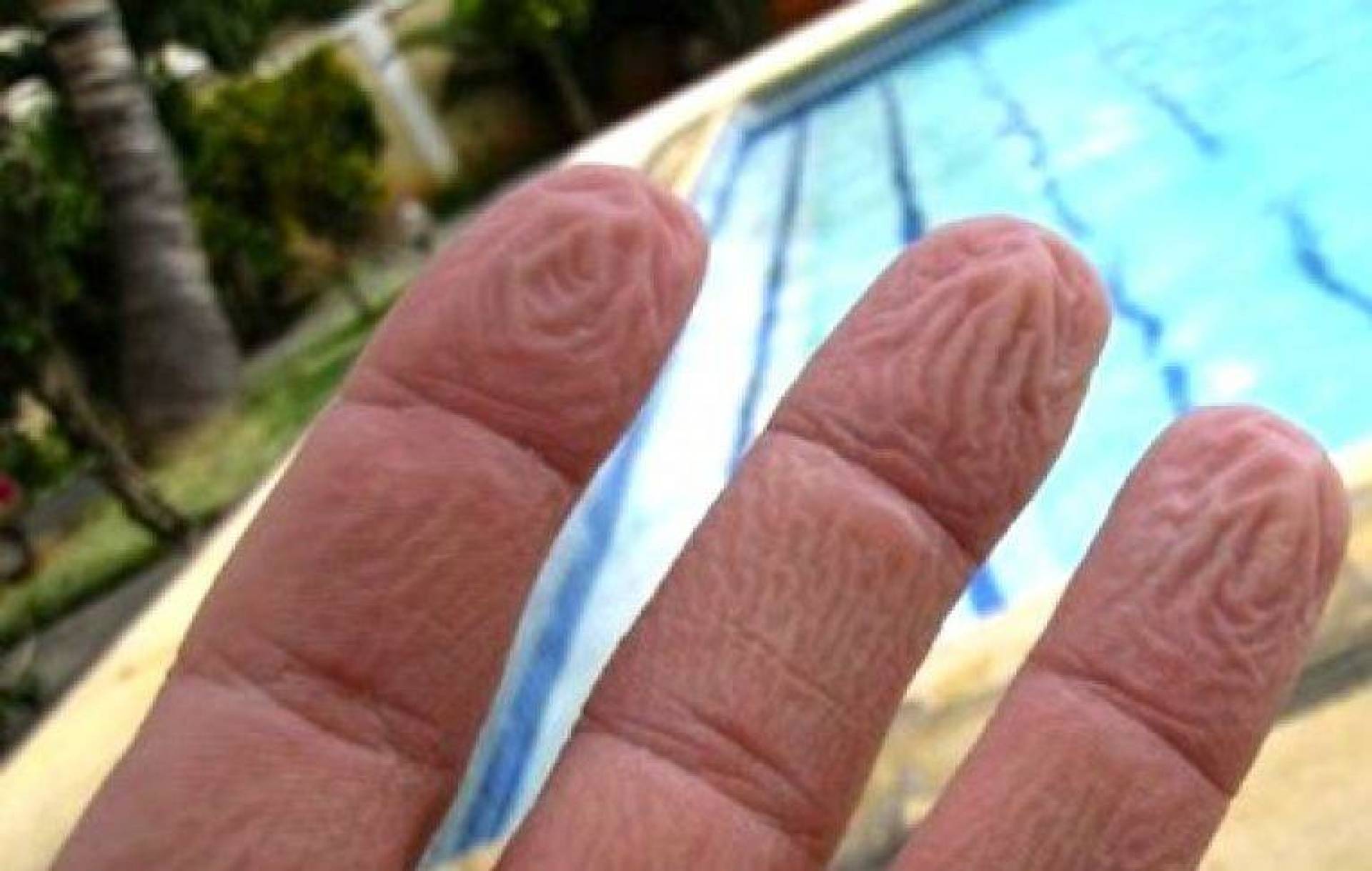 Руки после ванны. Сморщенная кожа на пальцах рук. Сморщенная кожа от воды. Авитаминоз на подушечках пальцев. Кожа на подушечках пальцев.